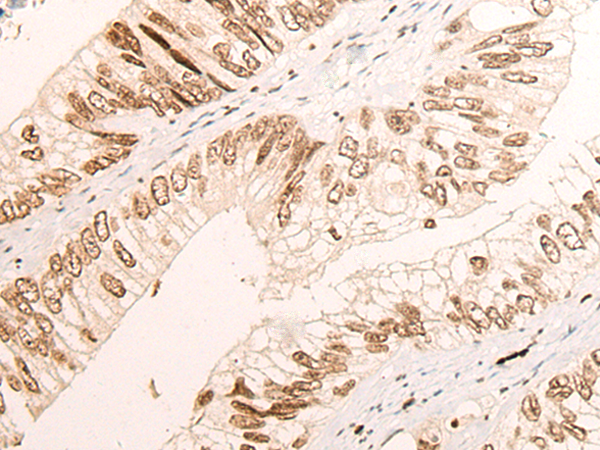 Rabbit Polyclonal Antibody to KMT2C