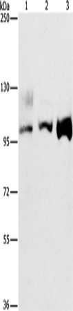 Rabbit Polyclonal Antibody to ASCC2