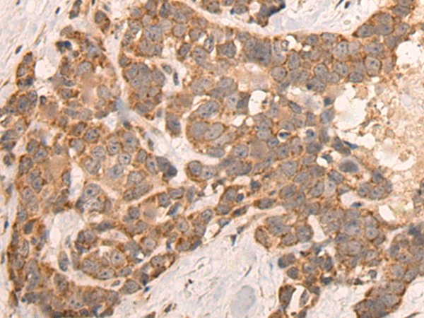 Rabbit Polyclonal Antibody to FOLH1