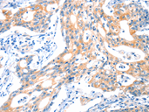 Rabbit Polyclonal Antibody to HTR3B