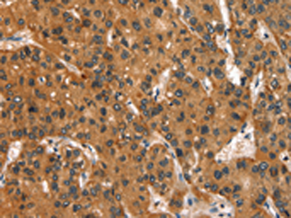 Rabbit Polyclonal Antibody to SLC6A4