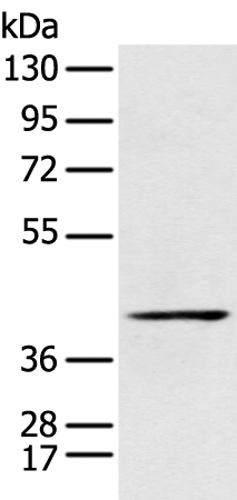 Rabbit Polyclonal Antibody to A4GALT