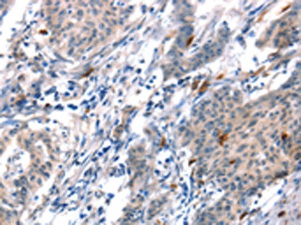 Rabbit Polyclonal Antibody to ADM