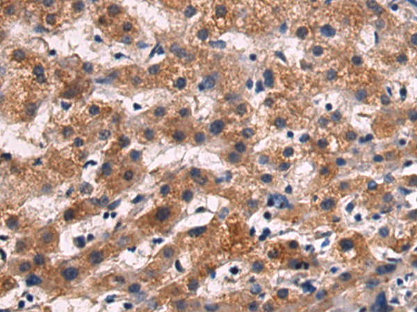 Rabbit Polyclonal Antibody to ALOX15
