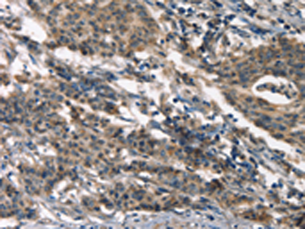 Rabbit Polyclonal Antibody to DEFA5