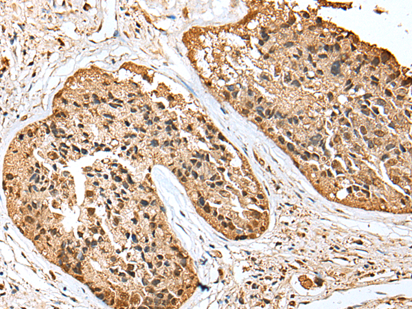 Rabbit Polyclonal Antibody to SCN1A