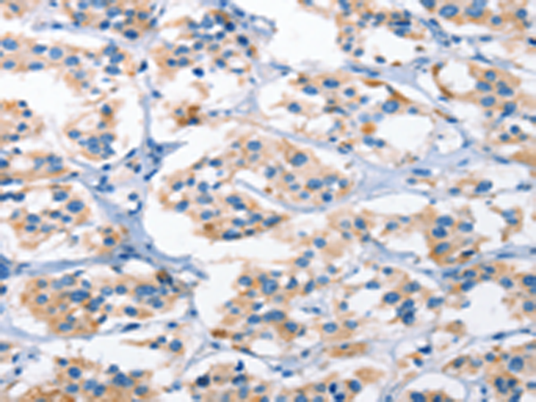 Rabbit Polyclonal Antibody to AHR