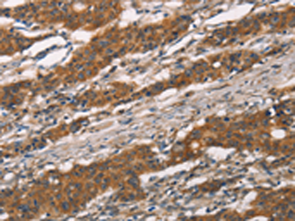 Rabbit Polyclonal Antibody to MMP2