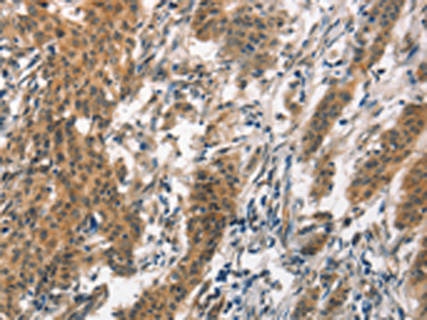 Rabbit Polyclonal Antibody to SMAD3