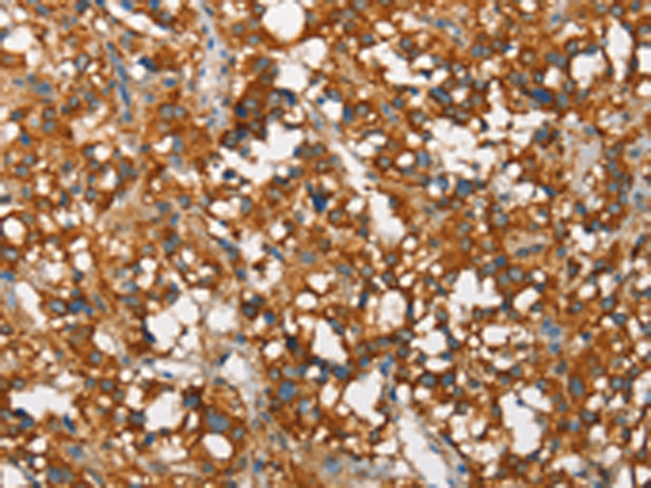 Rabbit Polyclonal Antibody to SNCA