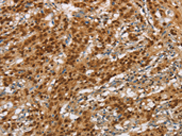 Rabbit Polyclonal Antibody to NLRP7