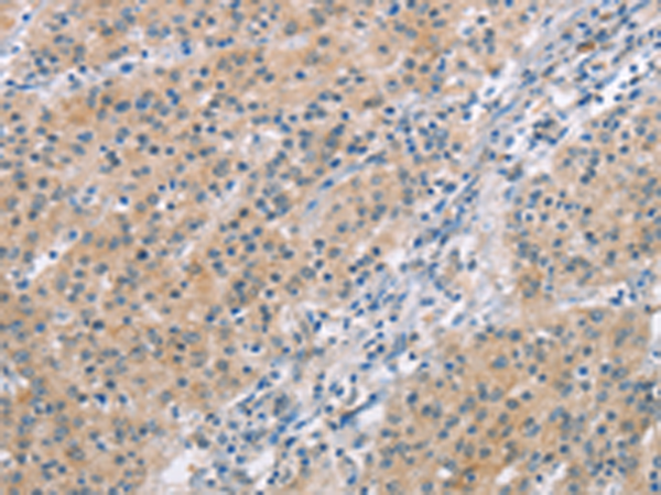Rabbit Polyclonal Antibody to MCL1