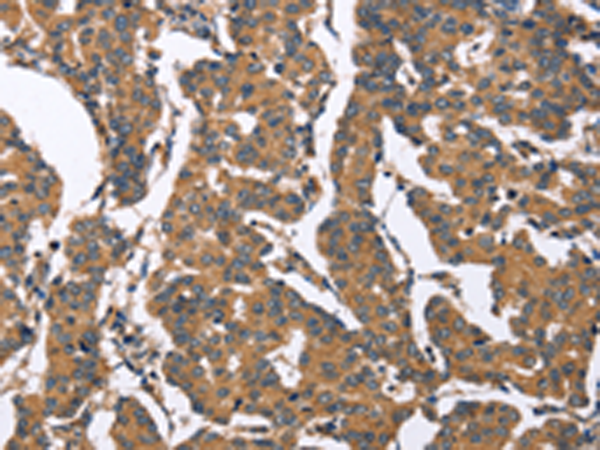Rabbit Polyclonal Antibody to BNIP2