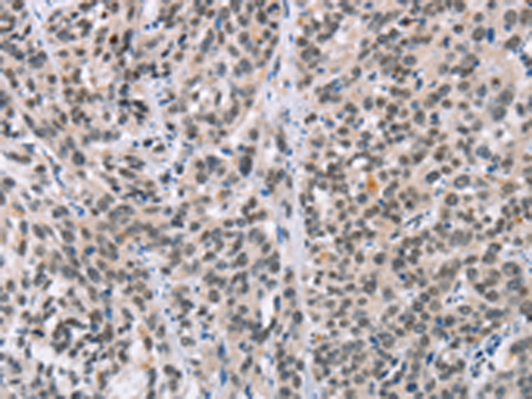 Rabbit Polyclonal Antibody to ADNP