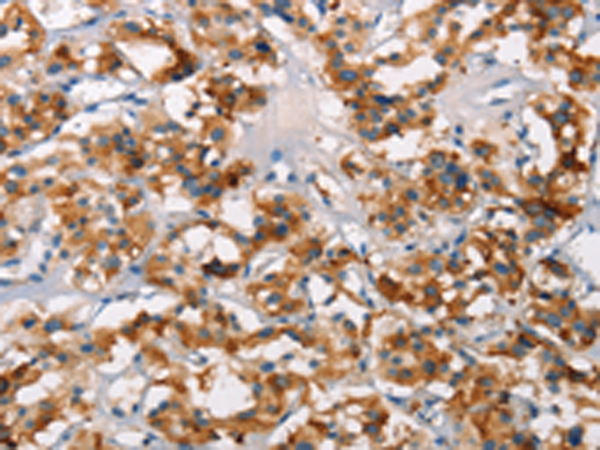 Rabbit Polyclonal Antibody to SH2B2