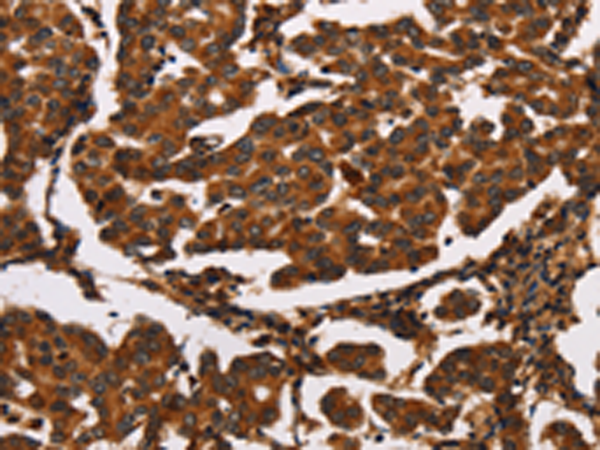 Rabbit Polyclonal Antibody to ARSB