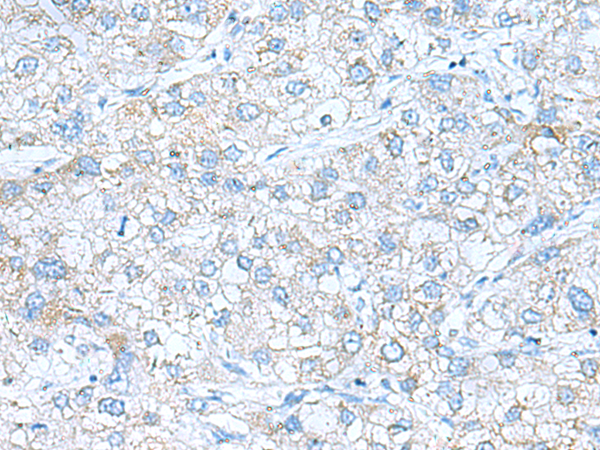 Rabbit Polyclonal Antibody to ASIC1