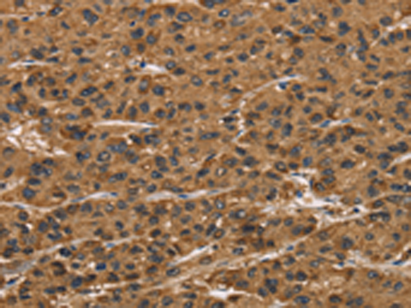 Rabbit Polyclonal Antibody to ATP7A