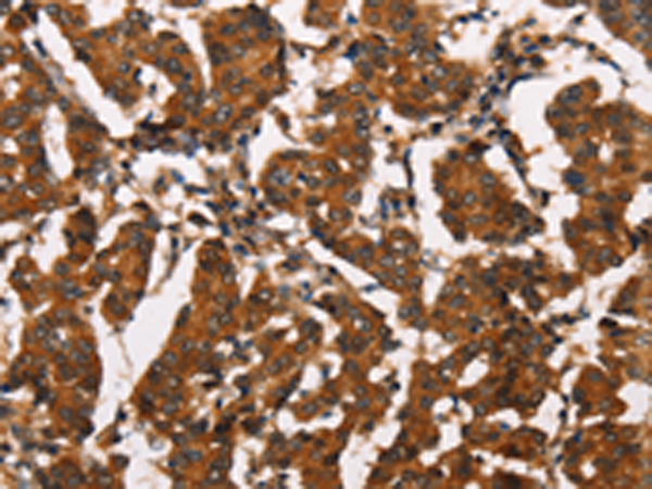 Rabbit Polyclonal Antibody to ATRN
