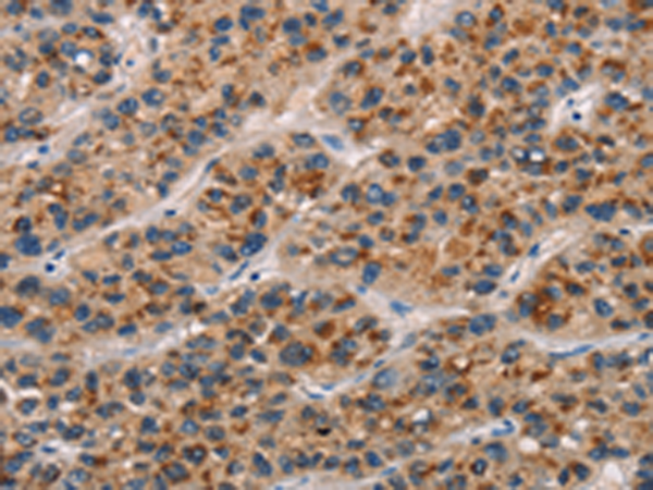 Rabbit Polyclonal Antibody to CD80