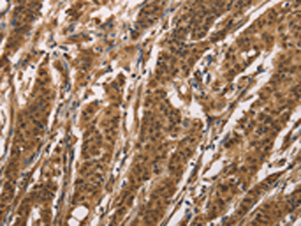 Rabbit Polyclonal Antibody to ADGRB1