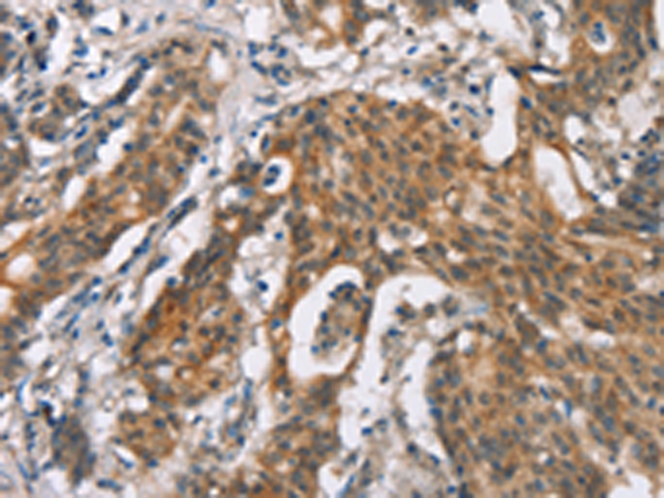 Rabbit Polyclonal Antibody to ADGRB2