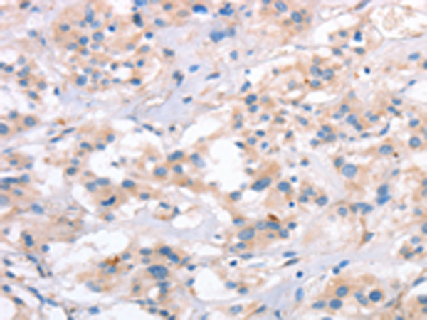 Rabbit Polyclonal Antibody to SLC4A1