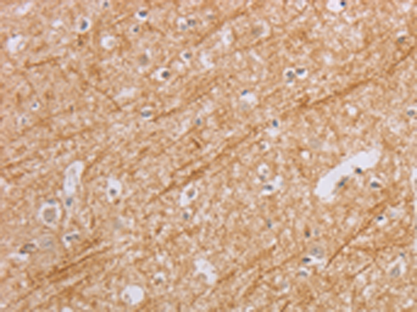 Rabbit Polyclonal Antibody to BGLAP