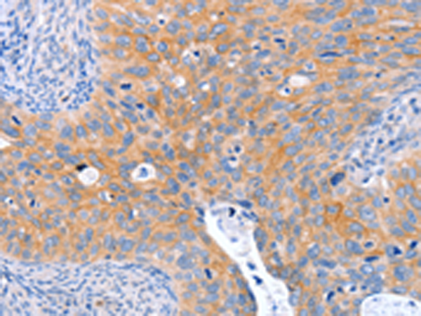 Rabbit Polyclonal Antibody to ABO