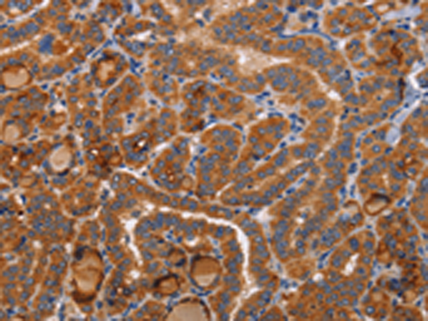 Rabbit Polyclonal Antibody to BMP6