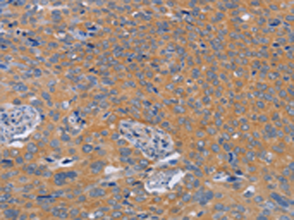 Rabbit Polyclonal Antibody to BOD1