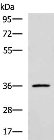Rabbit Polyclonal Antibody to IBSP