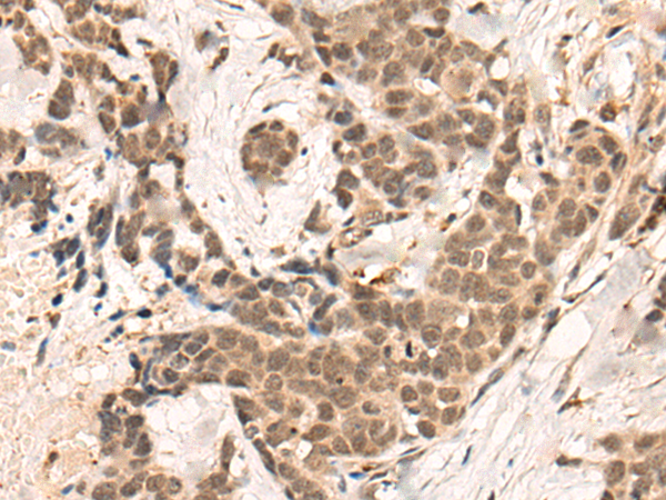Rabbit Polyclonal Antibody to BRD8