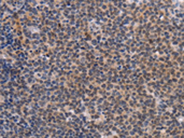 Rabbit Polyclonal Antibody to POU4F1