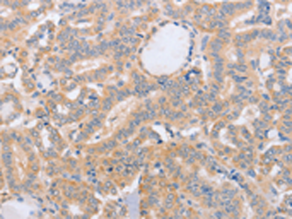 Rabbit Polyclonal Antibody to BST1