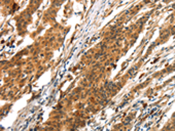 Rabbit Polyclonal Antibody to BCLAF1