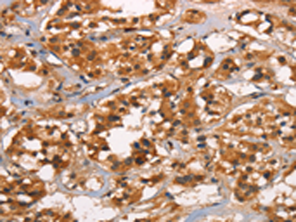 Rabbit Polyclonal Antibody to CABLES2