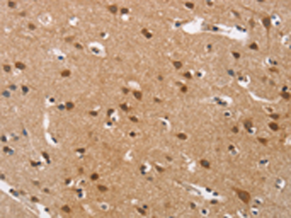 Rabbit Polyclonal Antibody to CACNA1D