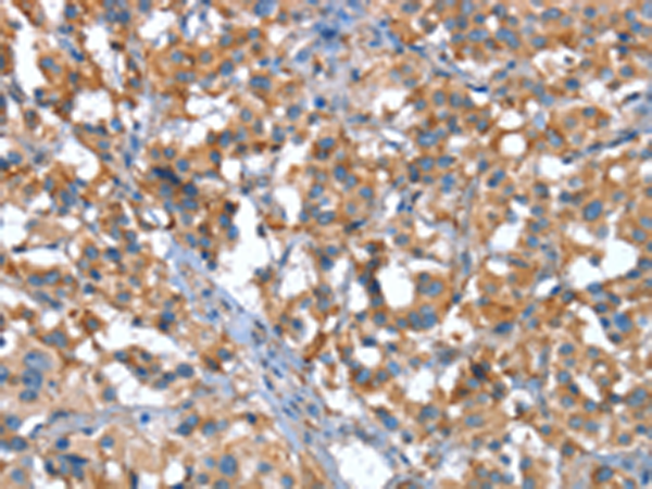 Rabbit Polyclonal Antibody to CACNA1G