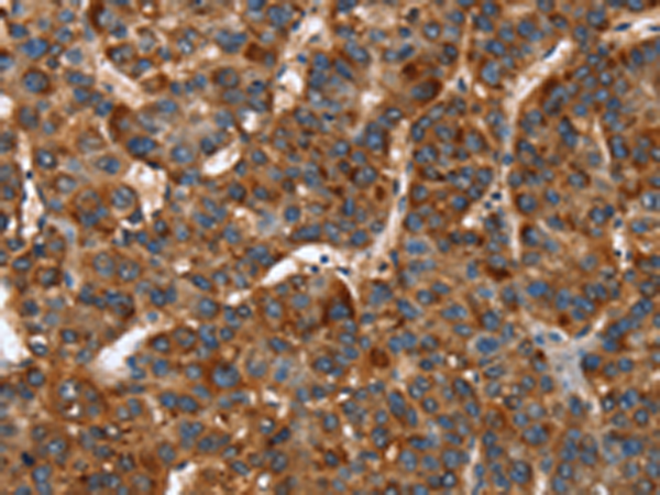Rabbit Polyclonal Antibody to CACNB2
