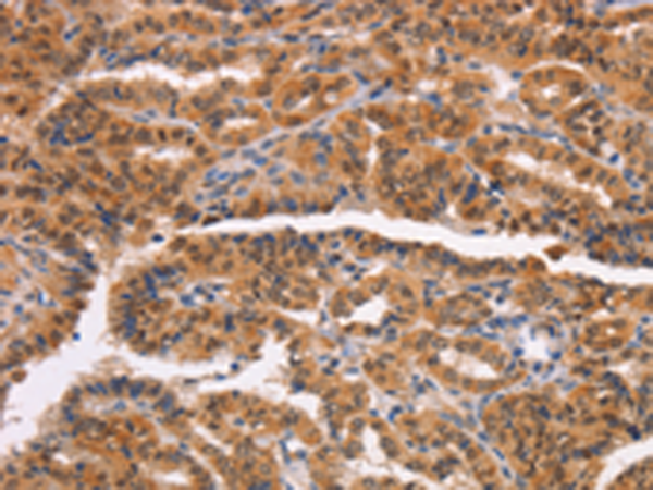 Rabbit Polyclonal Antibody to NCAPG2