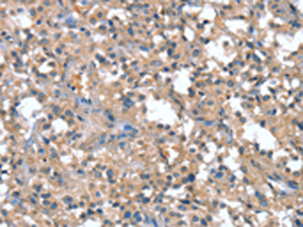 Rabbit Polyclonal Antibody to CAPZA1