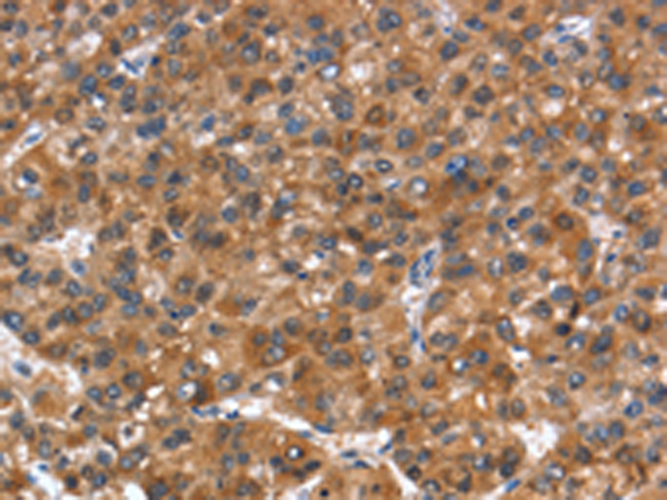 Rabbit Polyclonal Antibody to NOD2