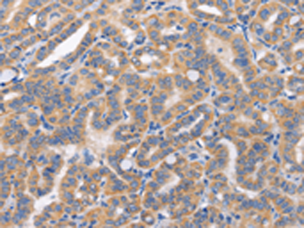 Rabbit Polyclonal Antibody to CARD17
