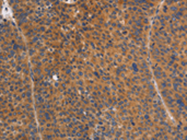 Rabbit Polyclonal Antibody to NOD1