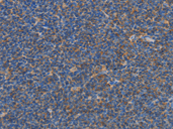 Rabbit Polyclonal Antibody to CARD6