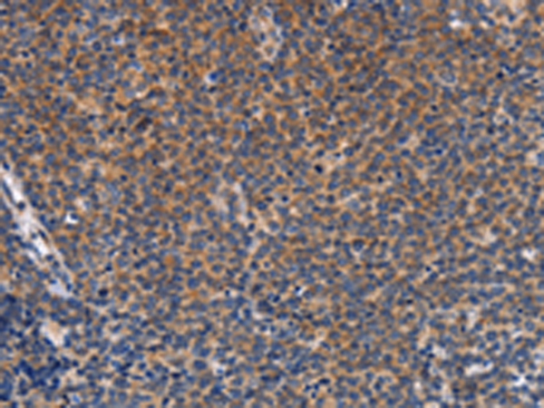 Rabbit Polyclonal Antibody to CCL23