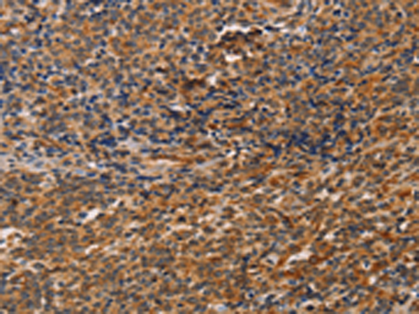 Rabbit Polyclonal Antibody to CCR5