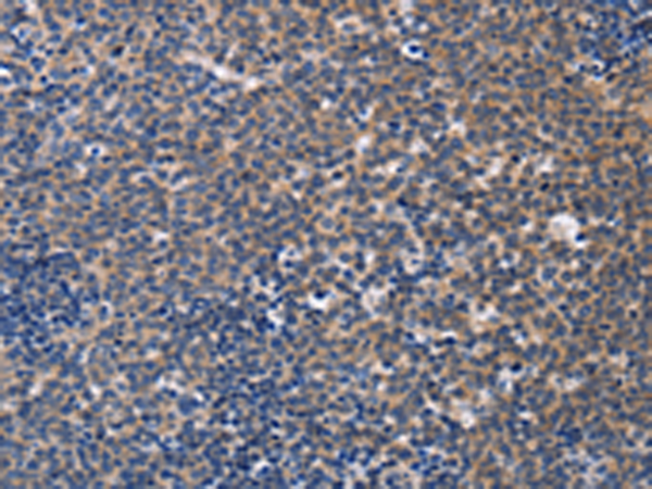 Rabbit Polyclonal Antibody to CCR6