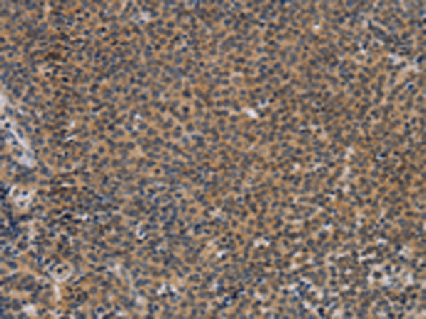 Rabbit Polyclonal Antibody to TNFRSF8